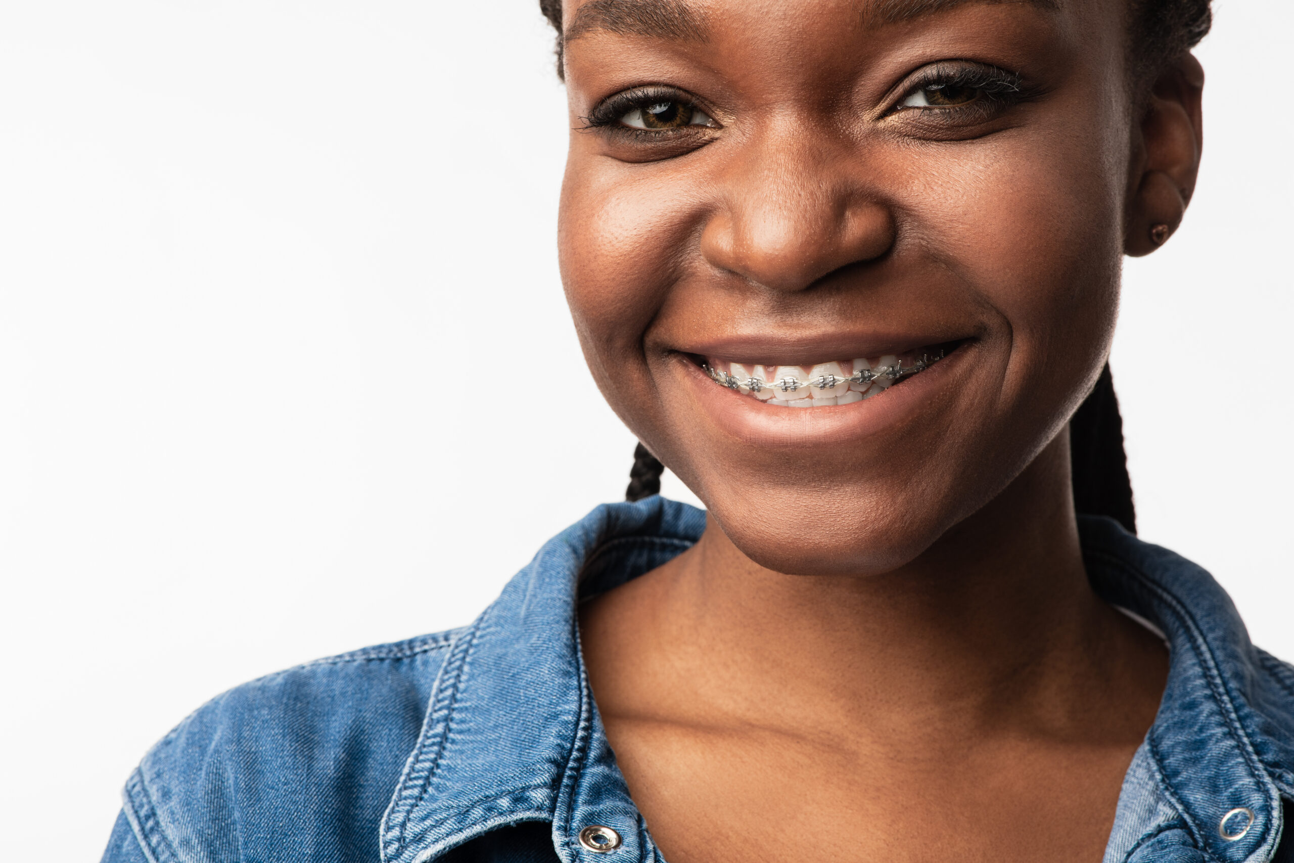 Dental Braces. Portrait Of African Girl With Brackets On Teeth Smiling To Camera Posing In Studio On White Background.