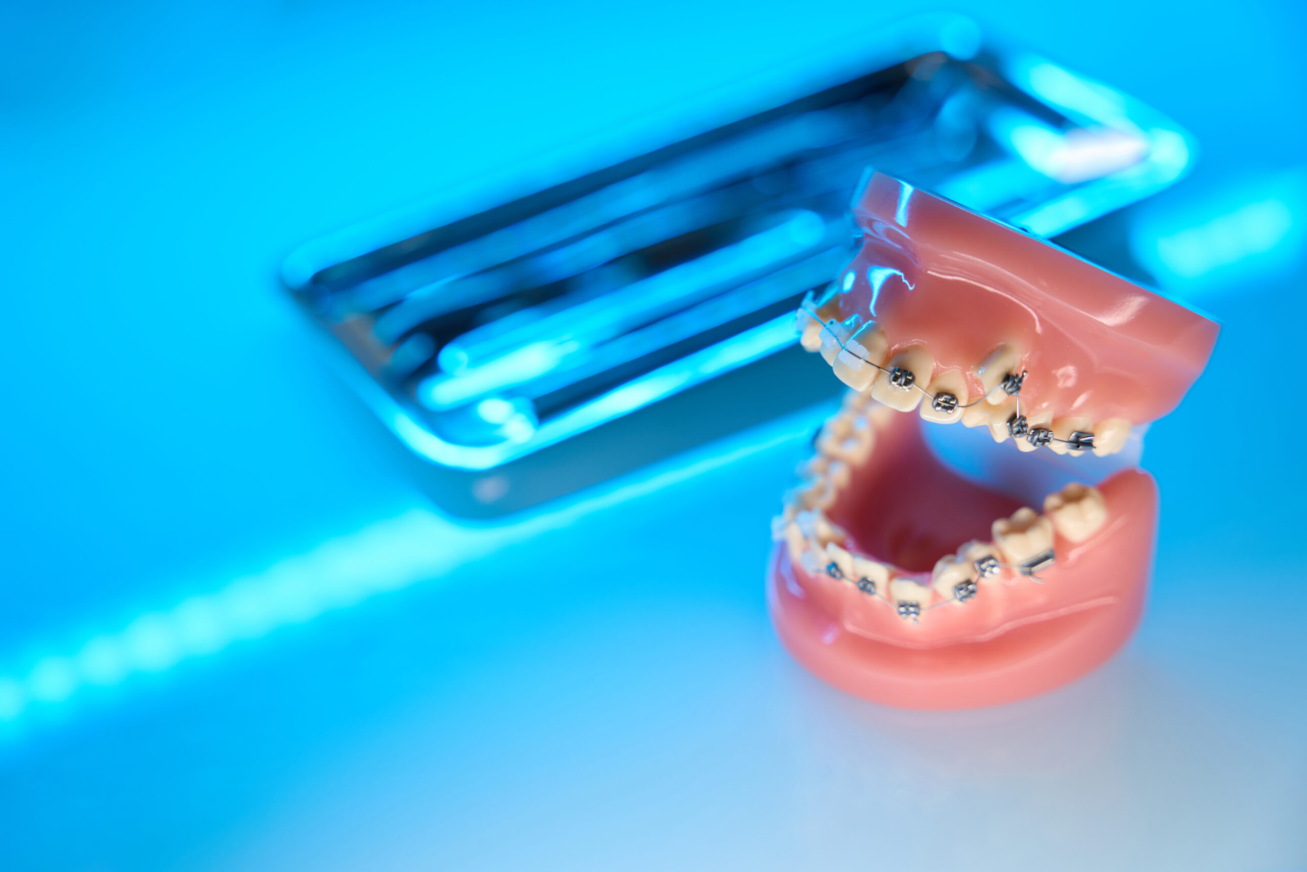 fake braces on a set of fake teeth showing how braces work in an orthodontist office