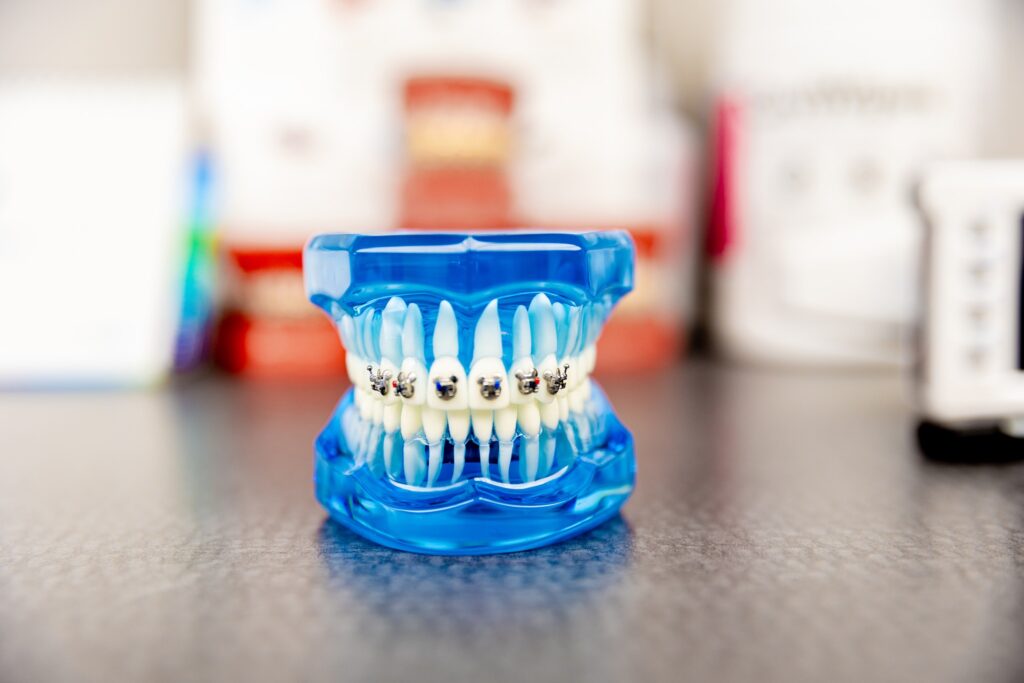 A photo of fake teeth showcasing designer braces that feature Mickey Mouse-shaped braces brackets